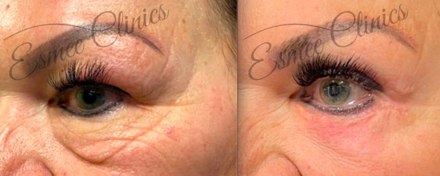 Before and After img